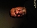See profile of 